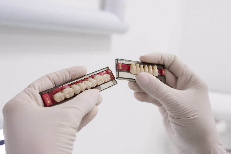 Cura dell'impianto dentale — Carpi Dental Service