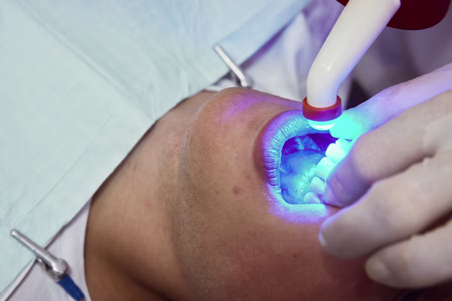 Sbiancamento denti professionale in studio — Carpi Dental Service